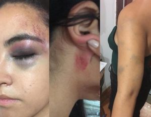 Lee más sobre el artículo Por una escena de celos, una joven de 19 años de edad, fue agredida físicamente y amenazada de muerte en Ibagué