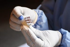Lee más sobre el artículo El Laboratorio de Salud Pública del Tolima inició la lectura de pruebas de covid-19