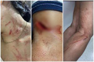 Lee más sobre el artículo ¡Repudiable! Mujer recibió brutal golpiza en la comuna Nueve de Ibagué