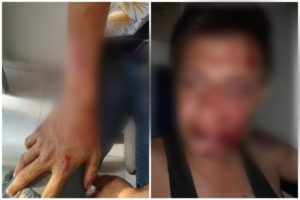 Lee más sobre el artículo Delincuente le dio brutal golpiza a un joven por robarle su celular en Ibagué
