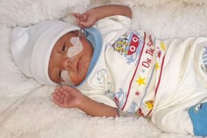 Lee más sobre el artículo Médicos de Ibagué hicieron ‘vaca’ para operar a un bebé de 2 meses que podía quedar ciego