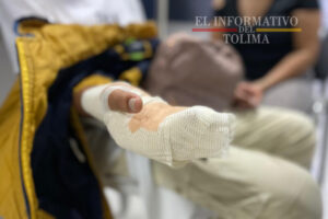 Lee más sobre el artículo ¡Vuelve y juega! Menor de edad resultó quemado con pólvora en Ibagué