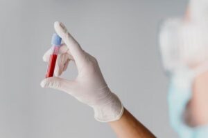 Lee más sobre el artículo ¡Pilas! Aumentan los casos de VIH en Ibagué