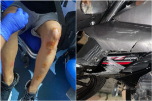 Lee más sobre el artículo ¡Irresponsable! En Ibagué, taxista arrolló a un motociclista y huyó del lugar