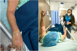 Lee más sobre el artículo Dos mujeres resultaron lesionadas por explosión de globos con helio en Ibagué