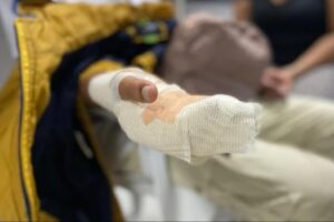 Lee más sobre el artículo Aumenta el número de personas quemadas con polvora en Ibagué