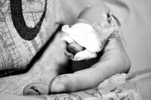 Lee más sobre el artículo Celebración de Año Nuevo dejó siete personas quemadas con pólvora en Ibagué