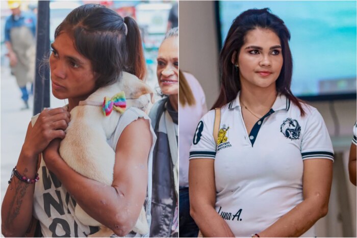 Lee más sobre el artículo Sandy Orjuela, la joven que decidió dejar la calle en una jornada de atención de la Alcaldía de Ibagué
