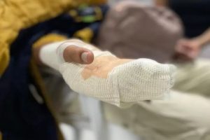 Lee más sobre el artículo Dos hombres resultaron quemados con pólvora en Ibagué durante la celebración de fin de año